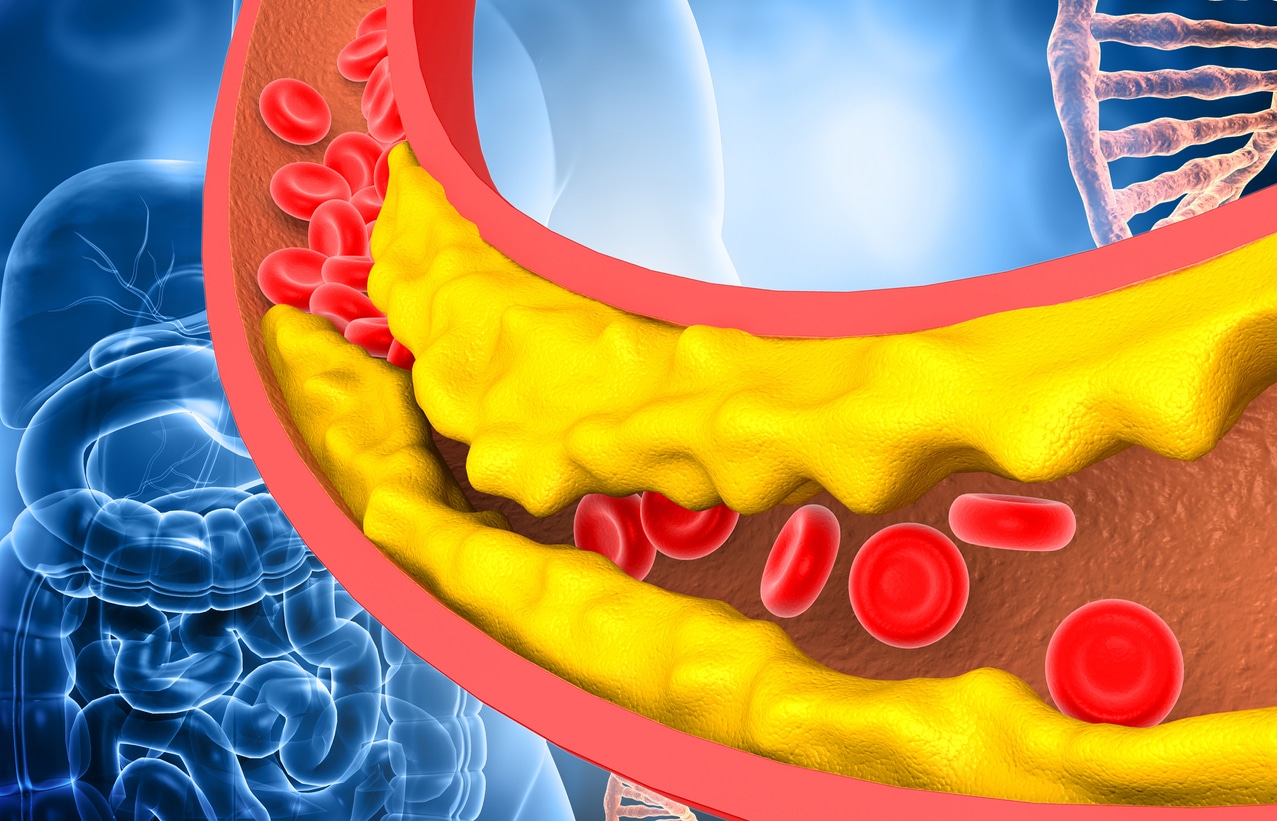 cholesterol